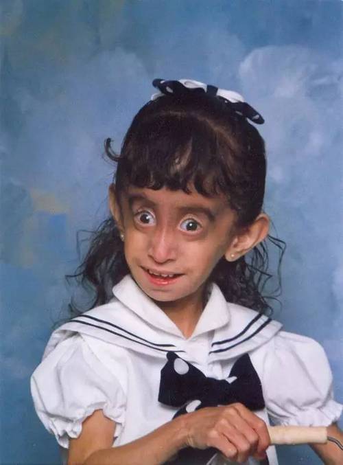 世界上最丑的人女生/世界上最丑的人女生是谁